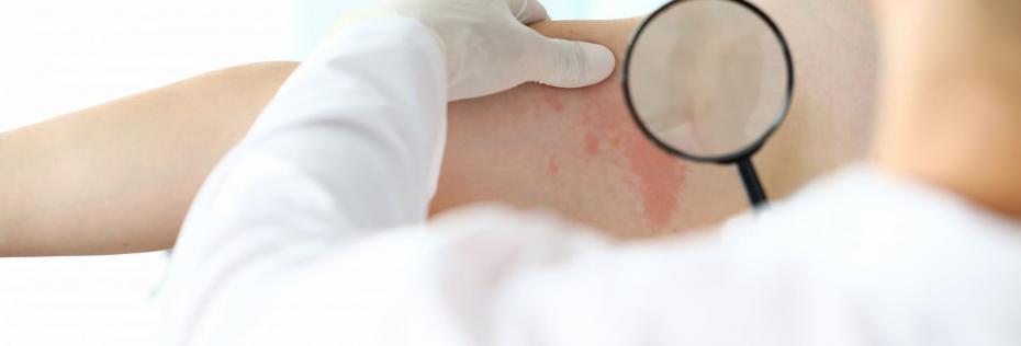 dermatolog